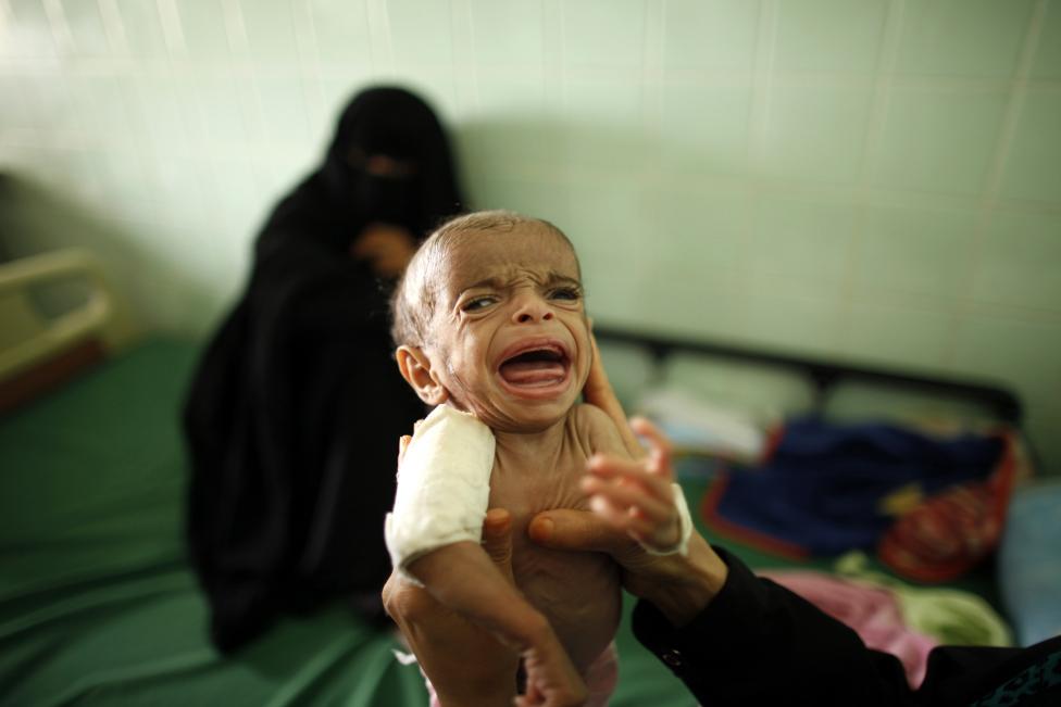 Cuatro meses de ataques aéreos saudíes en Yemen: Crisis humanitaria y alimentaria