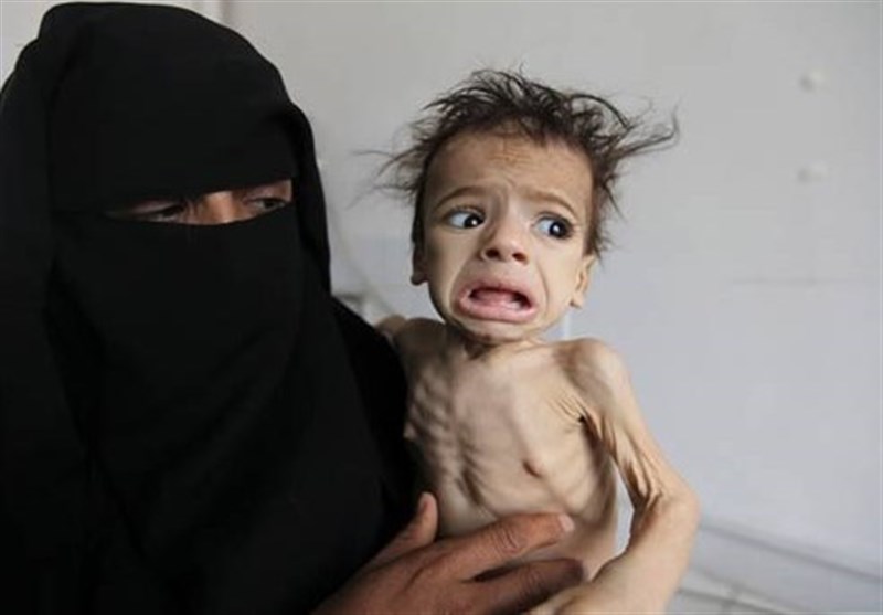 يعاني ملايين اليمنيين وعلى رأسهم الاطفال والنساء من المجاعة