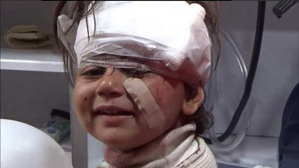 الطفلة السورية التي سقطت جريحة ضحية التفجير الارهابي في الراشدين