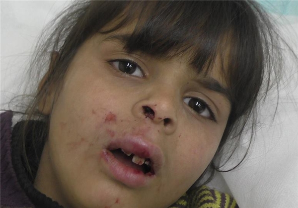 Colono israelí golpea a una niña palestina en Al-Jalil