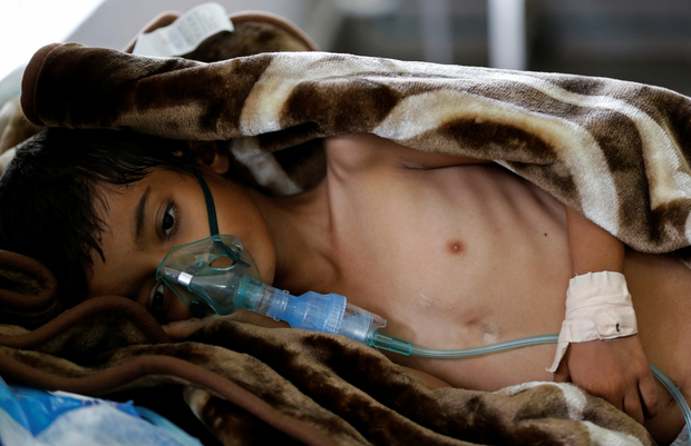 الصحة العالمية تعلن عن ارتفاع عدد المصابين بالكوليرا في اليمن