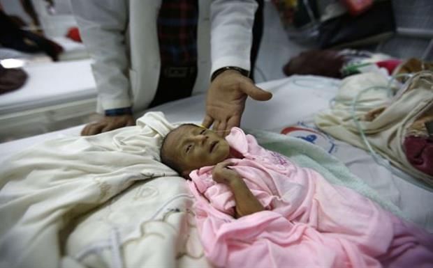 الأمم المتحدة: الجوع تحول الى وباء في اليمن نتيجة الحرب المتواصلة
