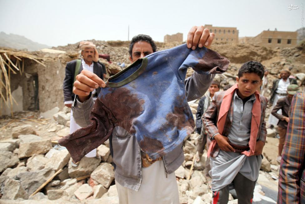 تجاوز عربستان به یمن و نقض حقوق کودکان