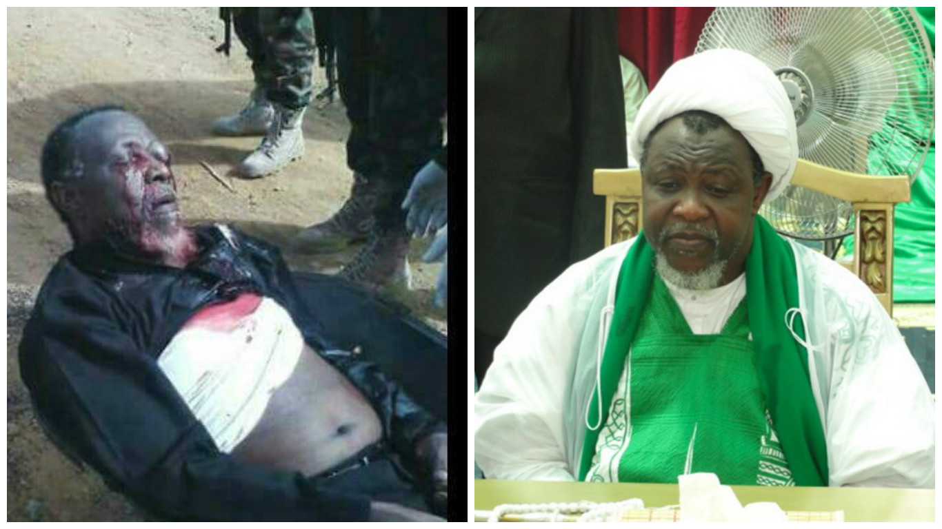 Nigerian Shiite Leader in Critical Conditions: Wife