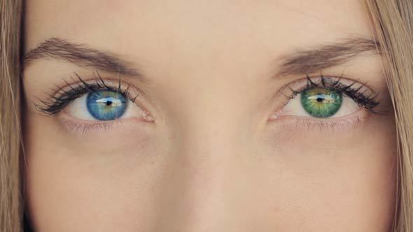 ما هي أسباب تغاير لون العينين؟