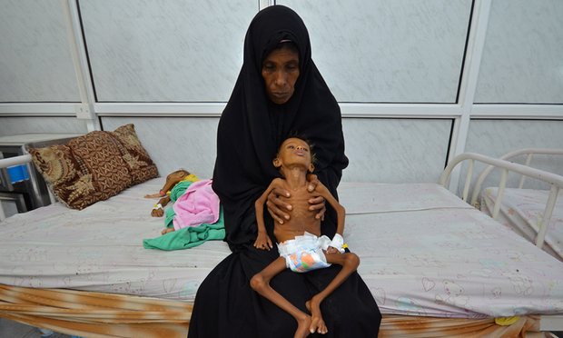 نيويورك تايمز: السعودية تشن حرب تجويع على الشعب اليمني