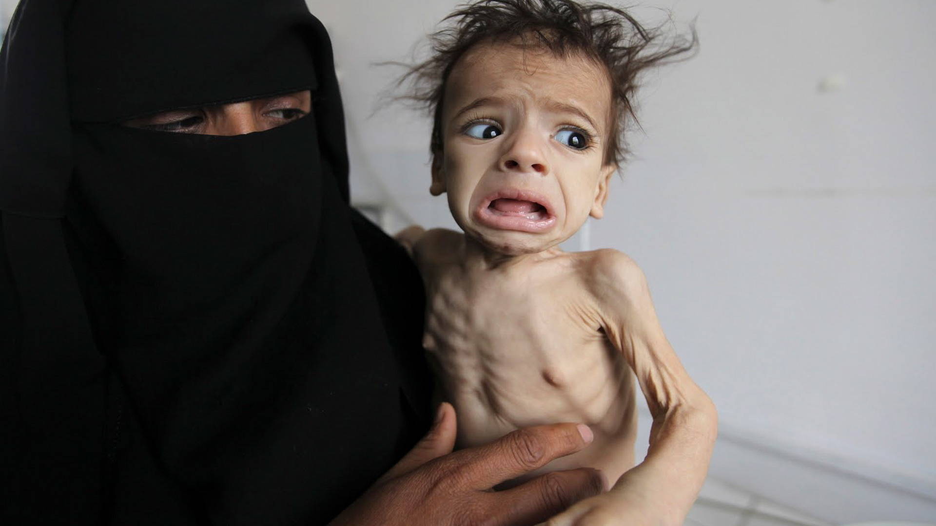 8.4 M Yemenis on Verge of Famine: UN