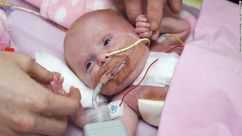 Nace una niña con el corazón fuera y sobrevive tras tres operaciones