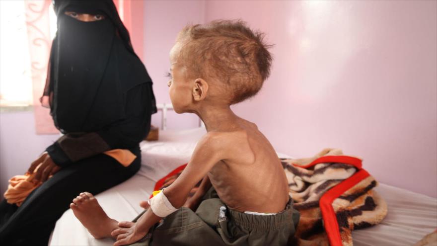 ONU: 14 millones de personas sufren escasez de alimentos en Yemen