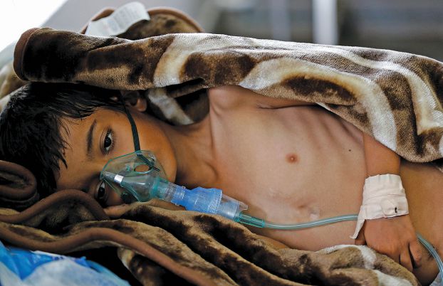 بسبب الحصار، الكوليرا تتحول الى وباء وتهدد حياة الملايين في اليمن