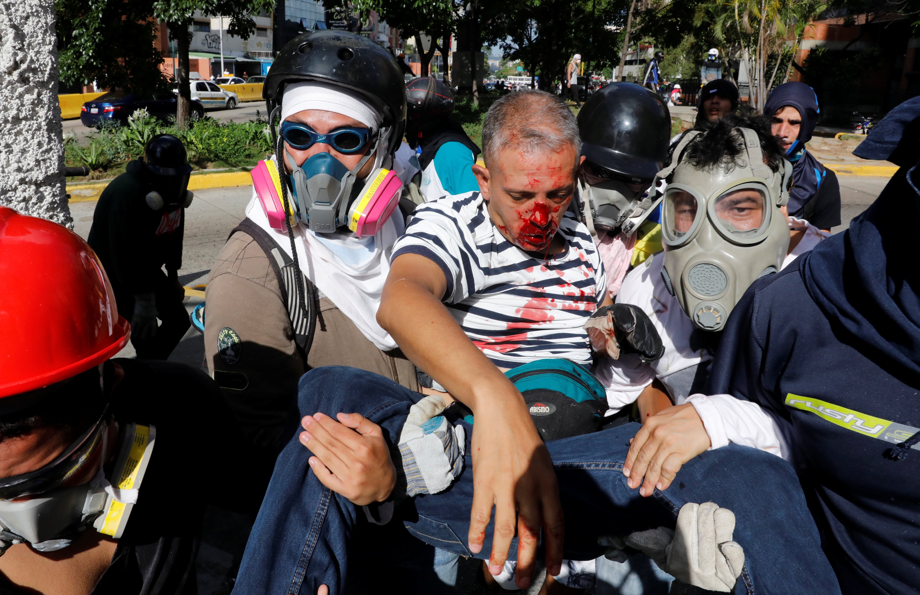 بالصور اشتباكات عنيفة بين الشرطة والمعارضة في فنزويلا