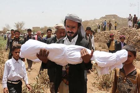 الكوارث البشرية في اليمن وردود الفعل الغربية المريبة