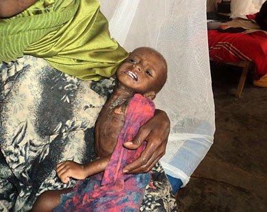 أكثر من 20 ألف طفل يواجهون خطر الموت جوعاً في الصومال