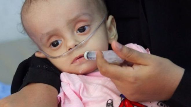 الاندبندنت: طفل يمني يفارق الحياة كل عشر دقائق
