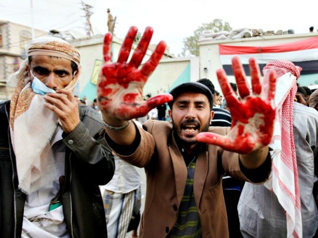 تکاپوی عربستان برای جلوگیری از افشای ابعاد جنایات ضدبشری یمن