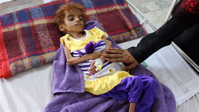 12m Yemenis on Brink of Worst Famine in 100 Years amid Saudi Aggression