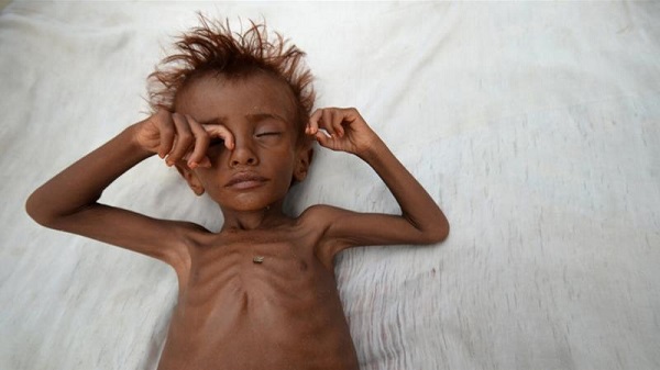 Over 7 Million Yemen Children Face “Severe” Famine Danger