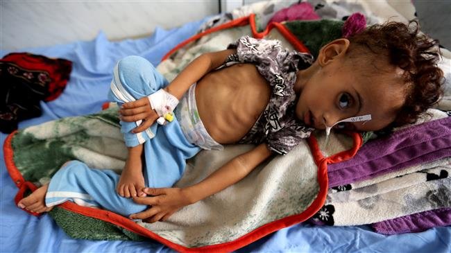 85,000 Yemeni Kids May Have Starved as Saudi Aggression: NGO