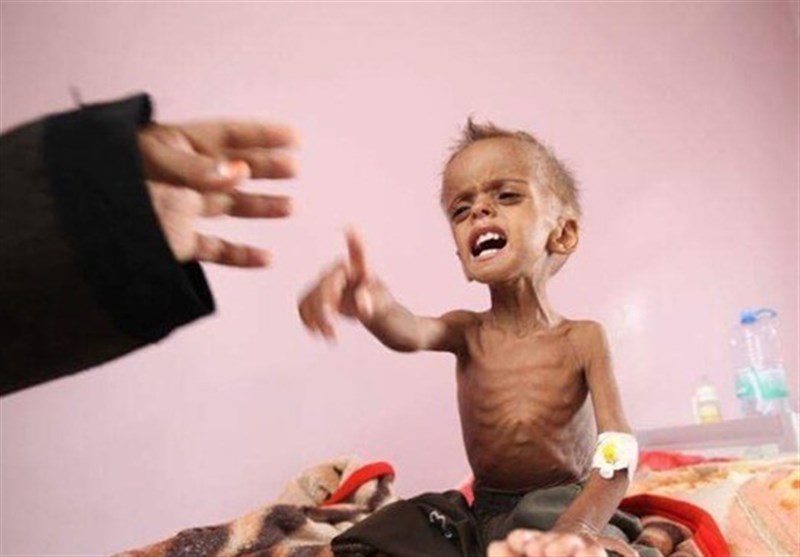 منظمة دولية: 85 ألف طفل يمني توفوا بسبب الحصار