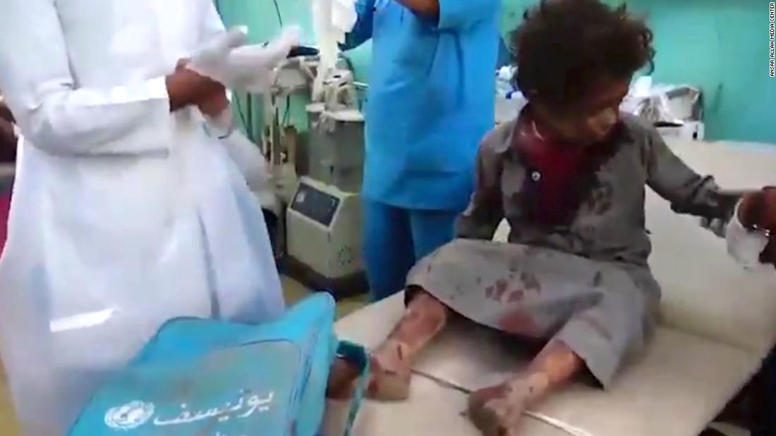 50 Killed, 77  Injured as Saudi-Led Coalition Strikes School Bus in Saada