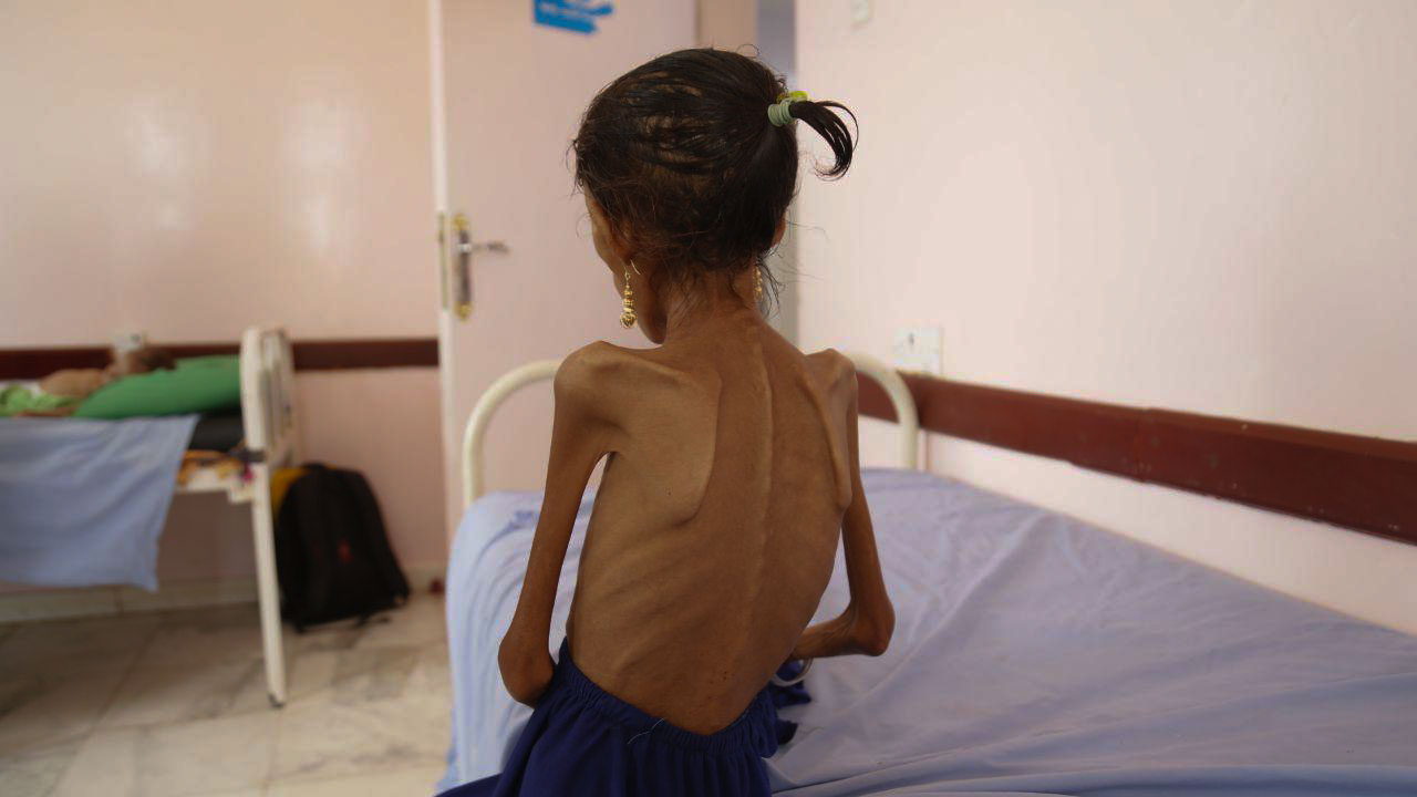 Five Years On, Saudi Attacks on Yemen’s Farmers Are Pushing the Whole Country into Famine