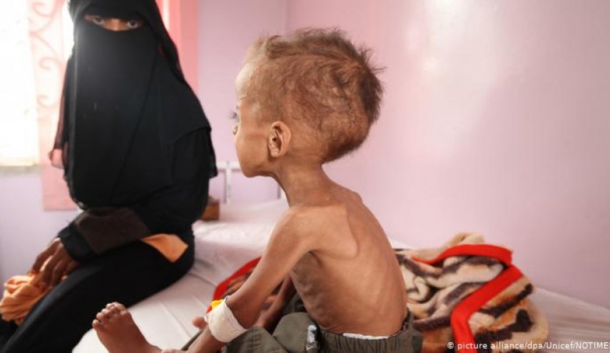 وكالات تابعة للأمم المتحدة تحذر من أن سوء التغذية الحاد يهدد نصف أطفال اليمن