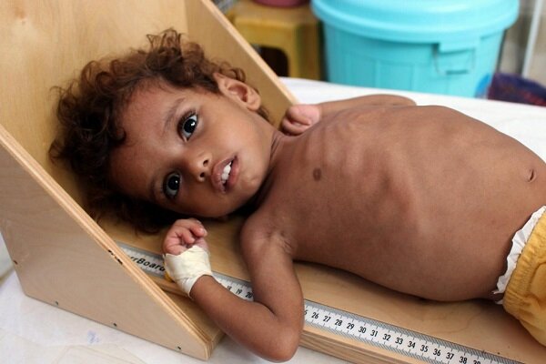 Over 400,000 Yemeni Children under 5 May Starve to Death in 2021: UN