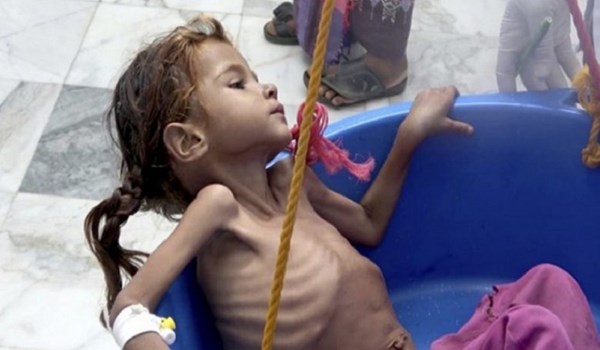 تقرير بريطاني: الاطفال يشكلون ربع الضحايا المدنيين في اليمن