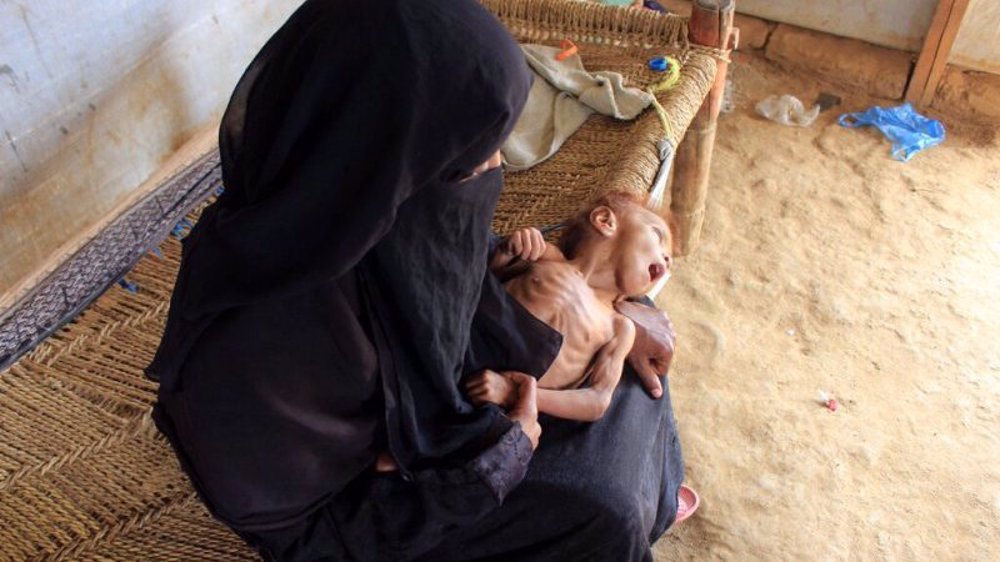 Ansarullah Decries UN ‘Weak’ Response to Yemen’s Humanitarian Crisis