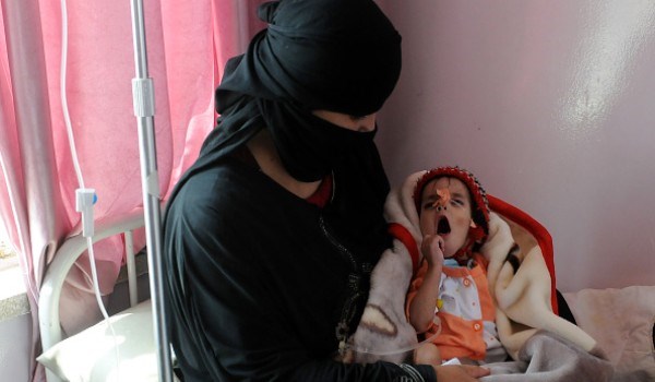 الصحة اليمنية: الأطفال يموتون بالمئات بسبب تنصل الأمم المتحدة عن القيام بدورها