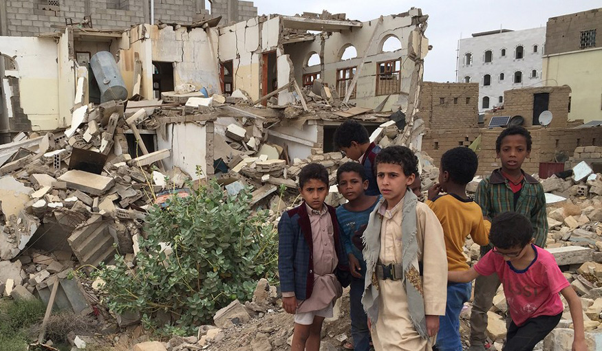Yemen’s Children Victims to Saudi Crimes, West’s  Double Standards