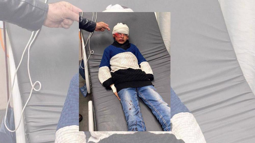 Extremist Israeli Settlers Violently Beat Palestinian Boy in Al-Khalil