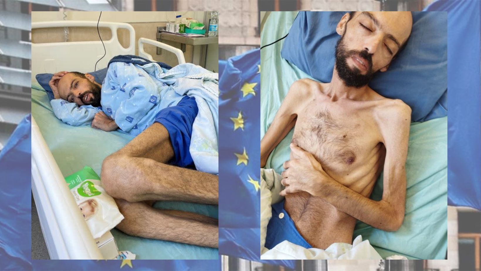 EU Shocked by Pictures of Nothing but Skin, Bones of Palestinian Hunger-Striker Detainee