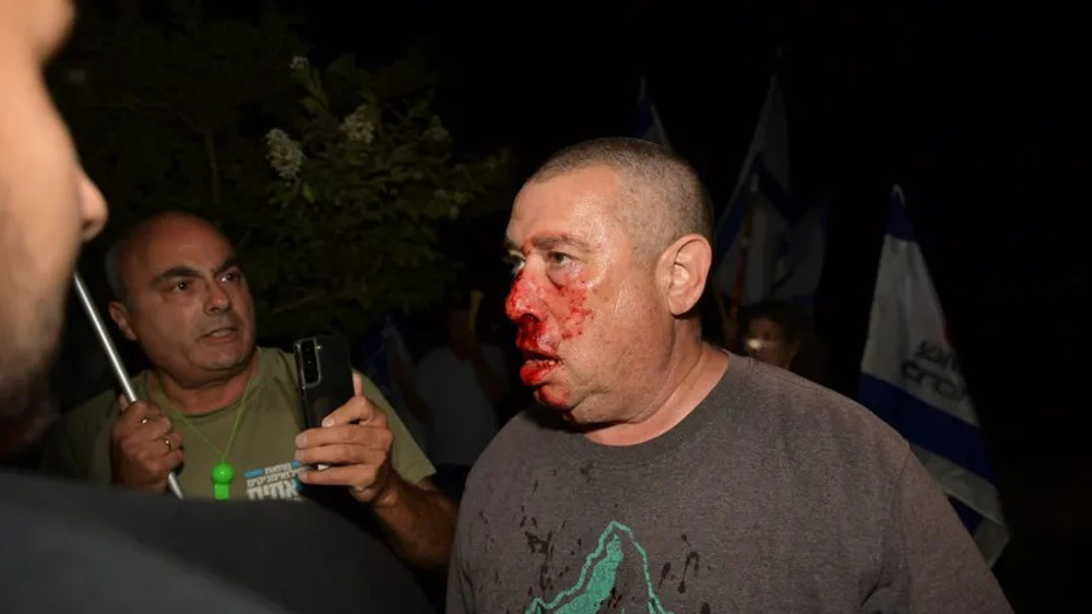 Israeli Forces Clash with Protesters near Netanyahu’s Residence