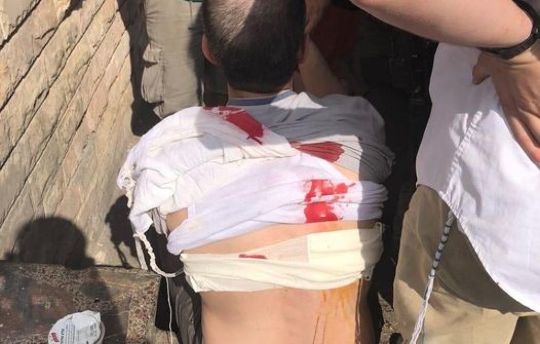 إصابة مستوطن في عملية طعن وانسحاب المنفذ غرب رام الله