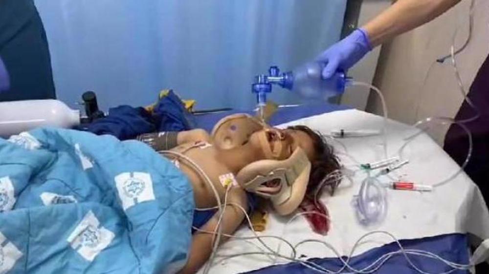 4-Y-O Palestinian Child in Critical Condition after Run Over by Israeli Settler