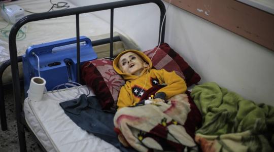 الأونروا": أكثر من 50 ألف طفل في قطاع غزّة يُعانون سوء التغذية الحاد