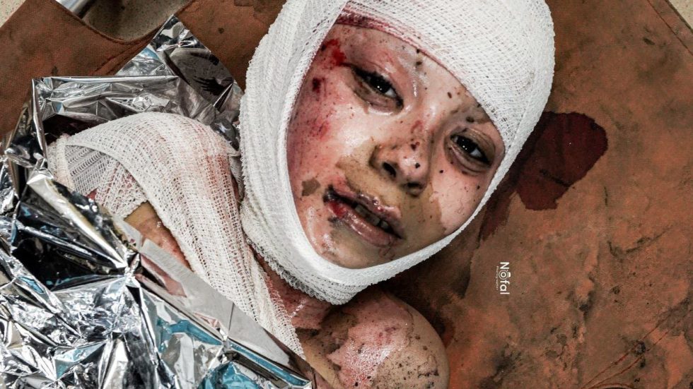 الإعلام الحكومي بغزة: 320 شهيدًا ومصابًا وصلوا لمستشفيات غزة بأجسادٍ محروقةٍ
