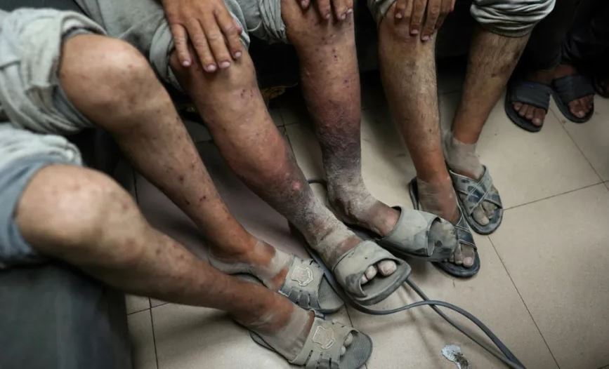 تعذيب ممنهج  بحق الأسرى الفلسطينيين تحت إشراف صهيوني رسمي