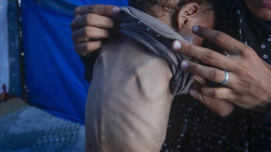 هشدار سازمان ملل به بحران گرسنگی در 16 نقطه جهان