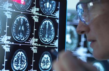 اكتشاف آلية ثورية لمكافحة ألزهايمر باستخدام مادة طبيعية في الجسم