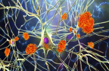 أدوية معروفة قد تحارب ألزهايمر!