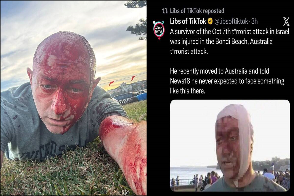 أحد الناجين من أحداث 7 أكتوبر يلتقط سيلفي لحادثة سيدني!