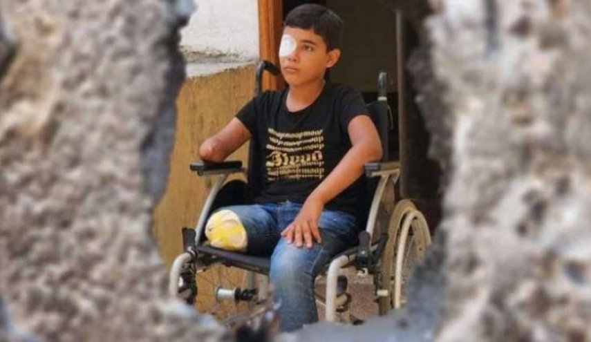 وزارة الصحة في غزة: 6000 حالة بتر بحاجة لبرامج تأهيل عاجلة في غزة