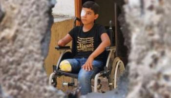 وزارة الصحة في غزة: 6000 حالة بتر بحاجة لبرامج تأهيل عاجلة في غزة