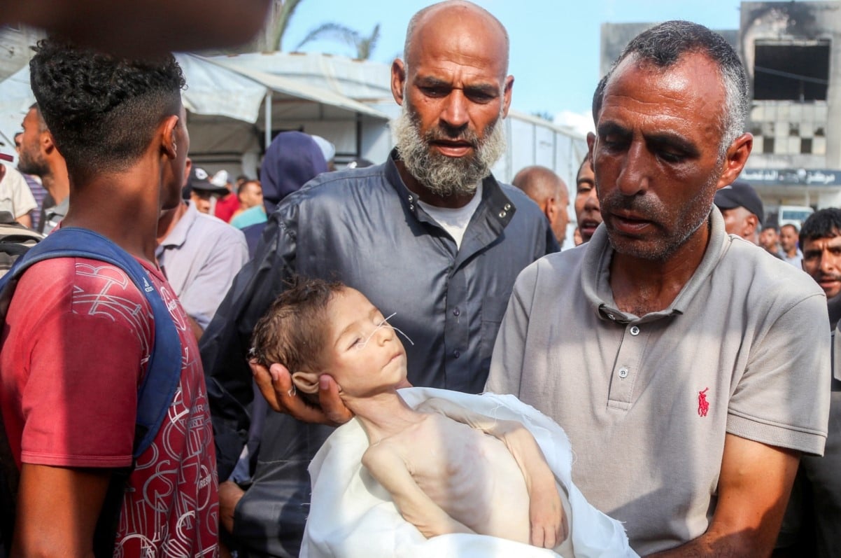 غزة: 76 طفلاً ارتقوا بسبب الجوع.. ونحو ألف شهيد من منتظري المساعدات خلال شهرين