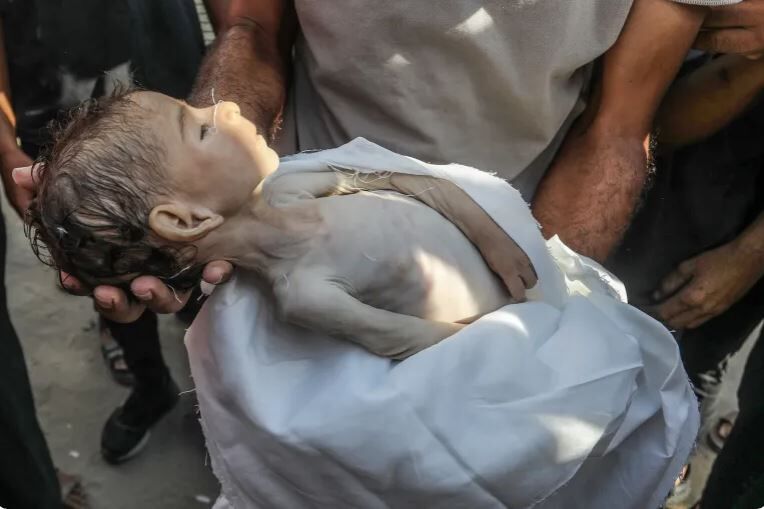مدير مجمع الشفاء الطبي في غزة: 127 شهيدا بينهم 85 طفلا بسبب الجوع