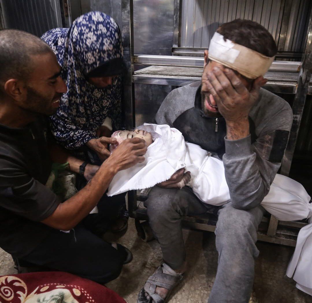 وزارة الصحة بغزة: ارتفاع عدد شهداء المجاعة وسوء التغذية إلى 217 شخصا في قطاع غزة