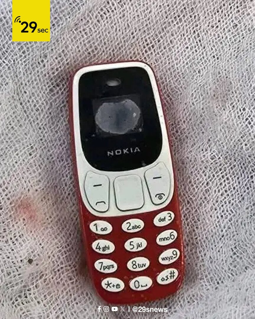 فريق طبي مصري يستخرج هاتفا من معدة مريض