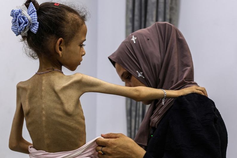 الأغذية العالمي: نصف مليون شخص بغزة على شفا المجاعة